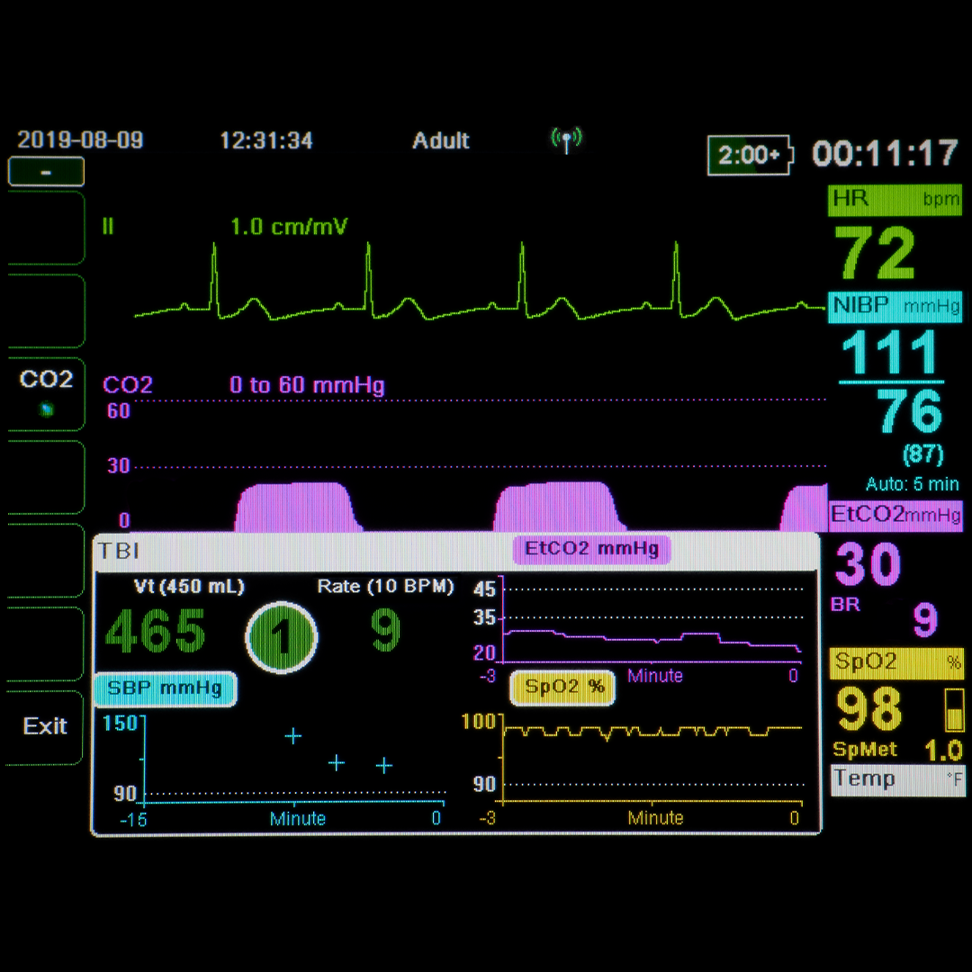 zoll-x-series-advanced-panel-tbi